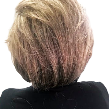 protese-capilar-feminina