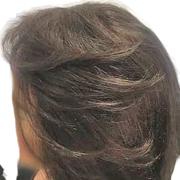 protese-capilar-feminina