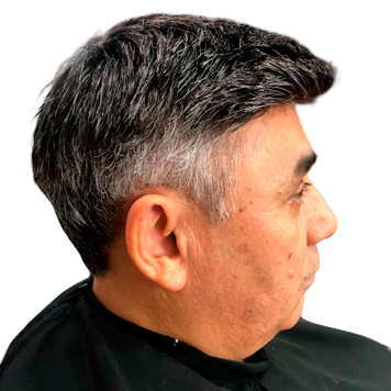 protese-capilar-masculino